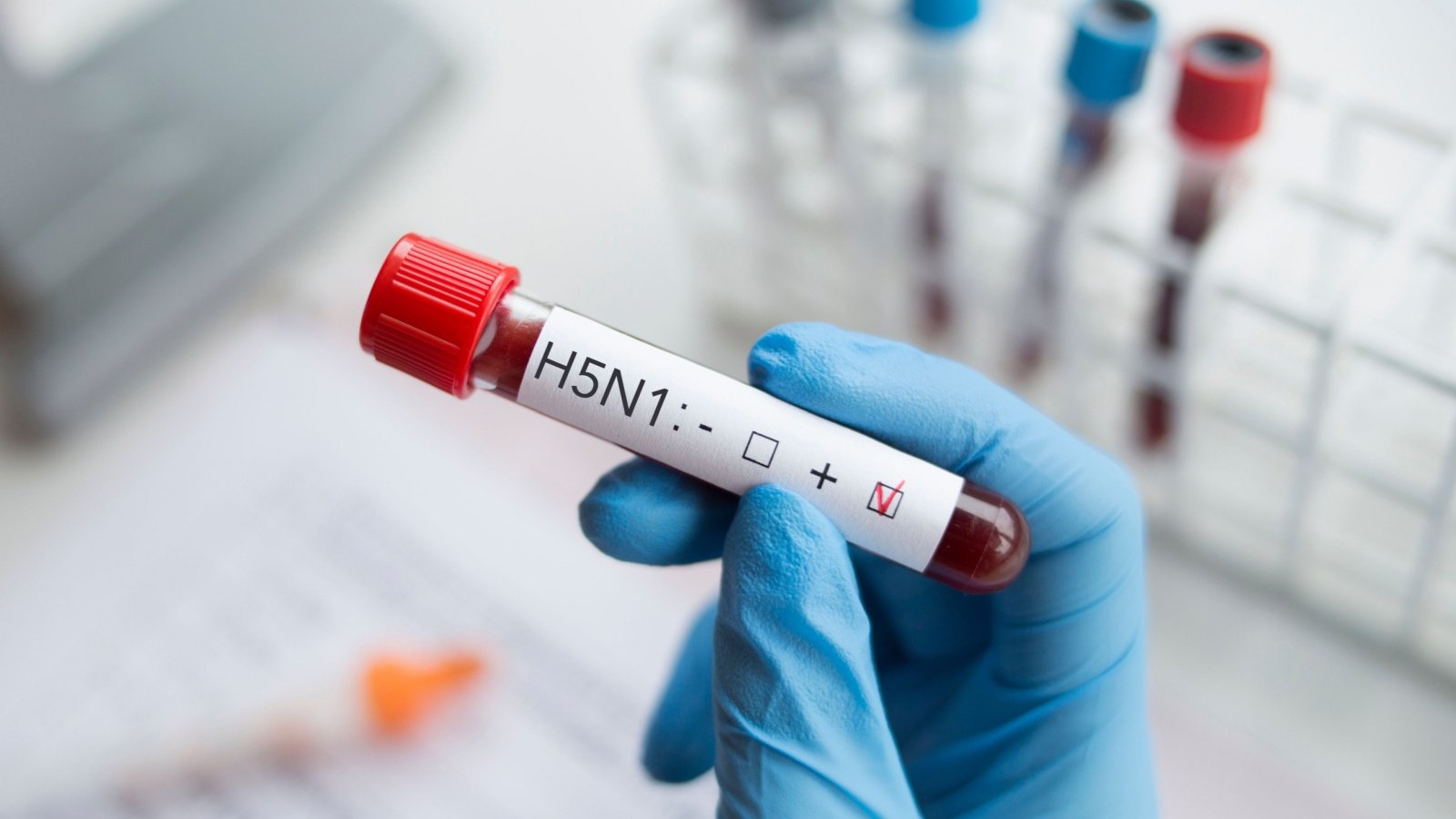 Blood sample positive with H5N1 influenza virus mikeforemniakowski Shutterstock