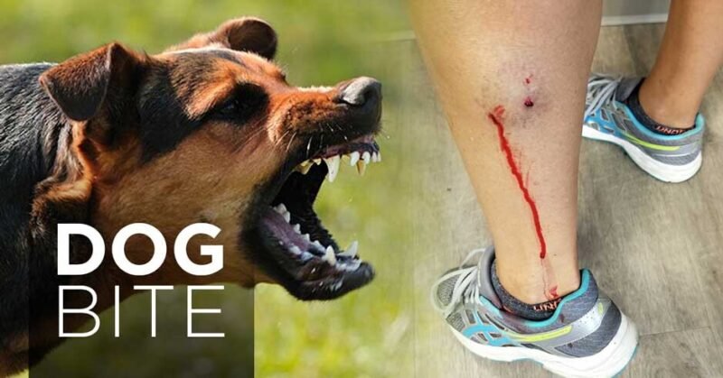 What Every Pet Owner Should Know About Dog Bite Laws